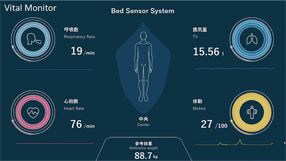 Vital Monitor